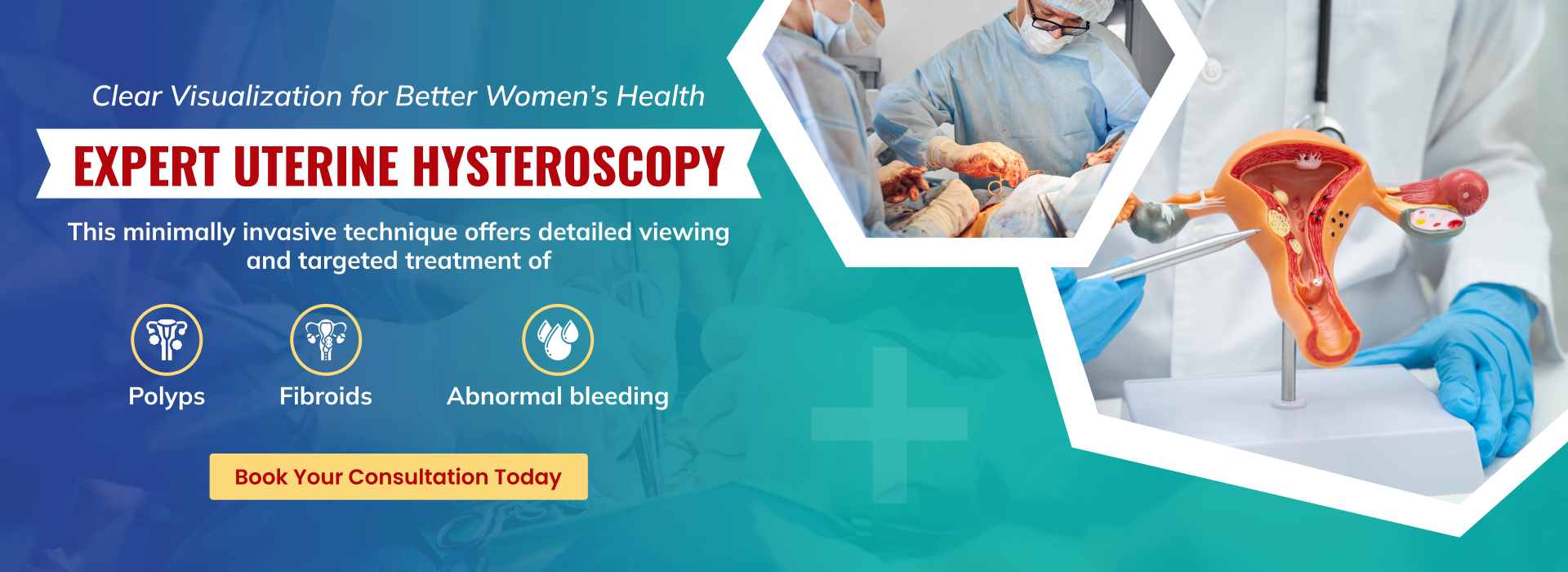 Hyateroscopy (1)