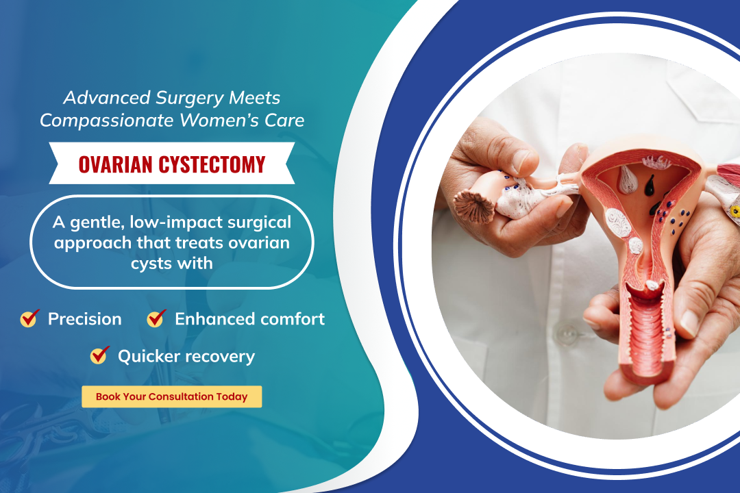 ovarian cyst mobile banner